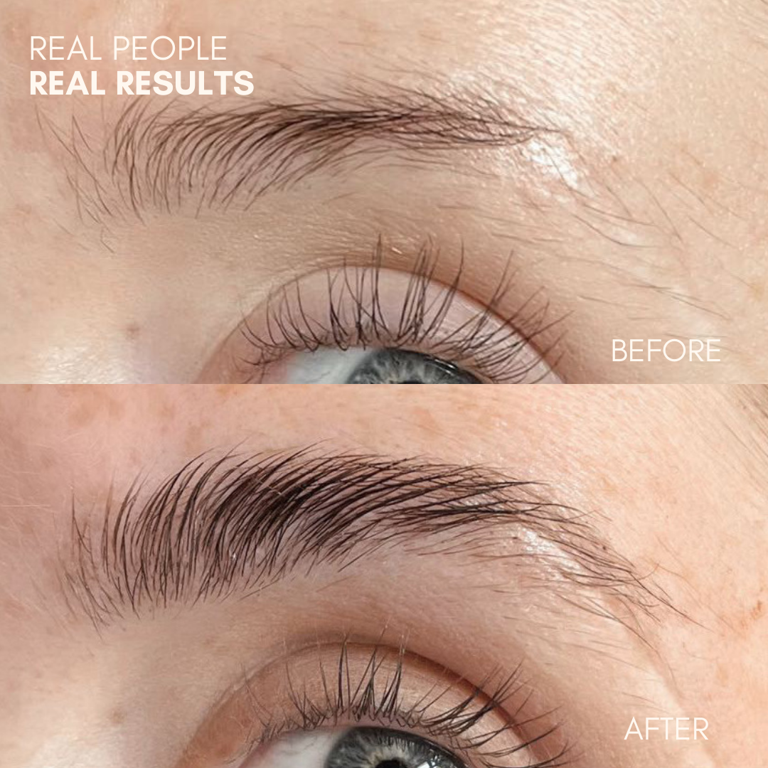 Brow Growth Serum
