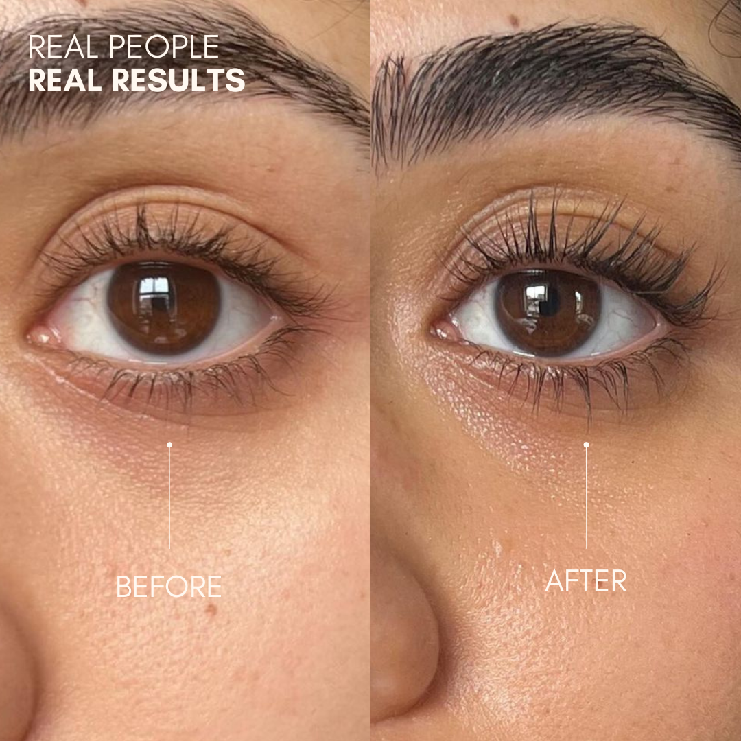 Best Lash Serum Results