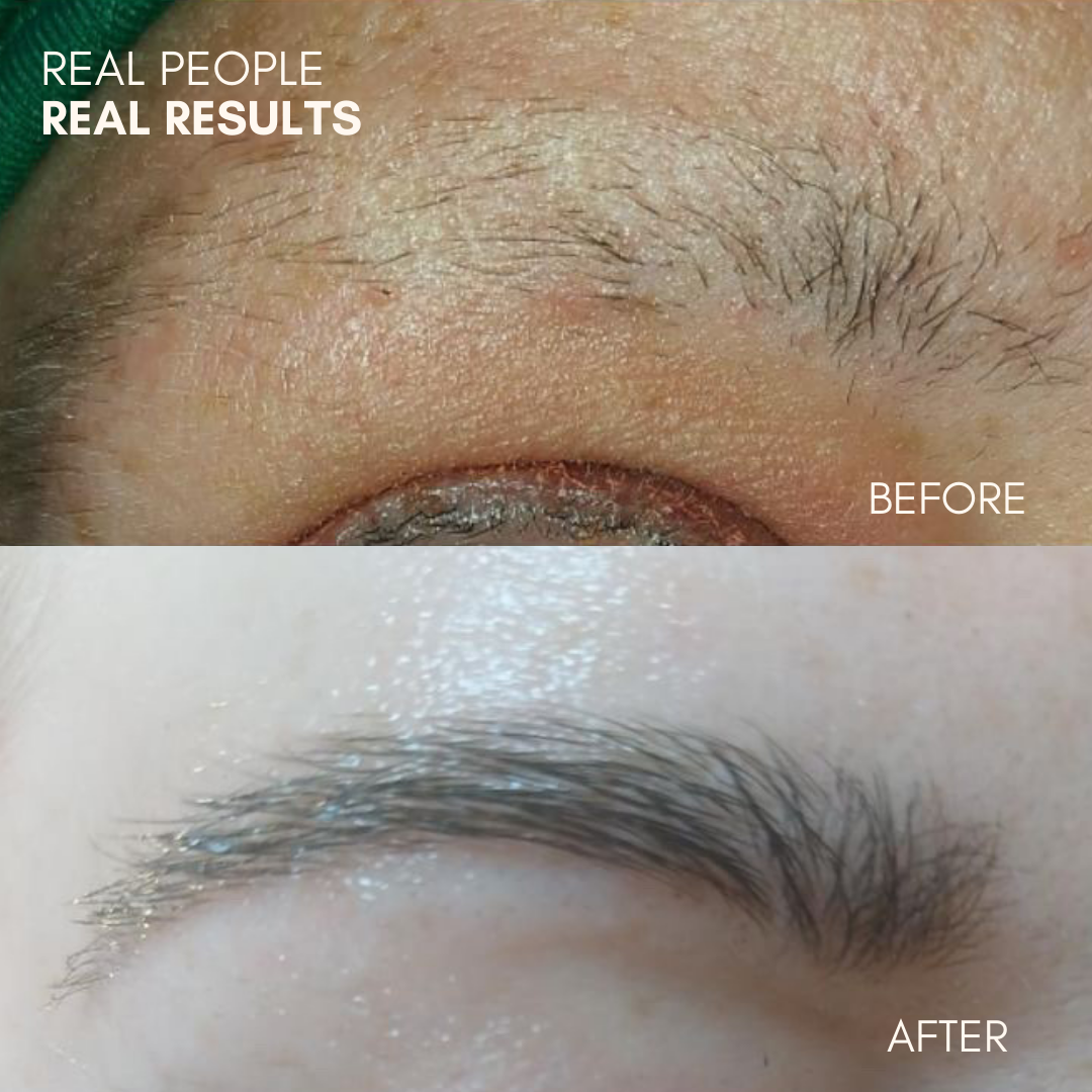 Brow Growth Serum