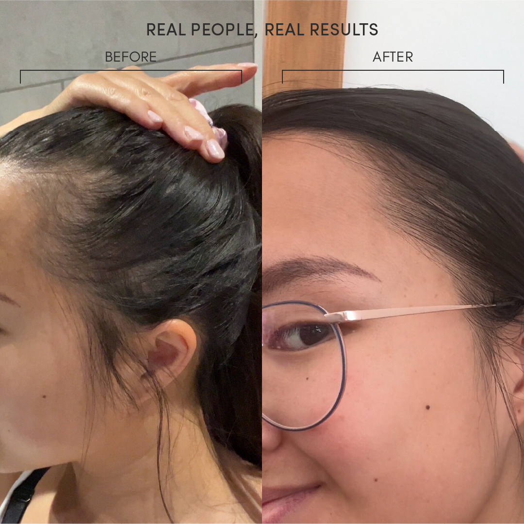 Hair Growth Serum