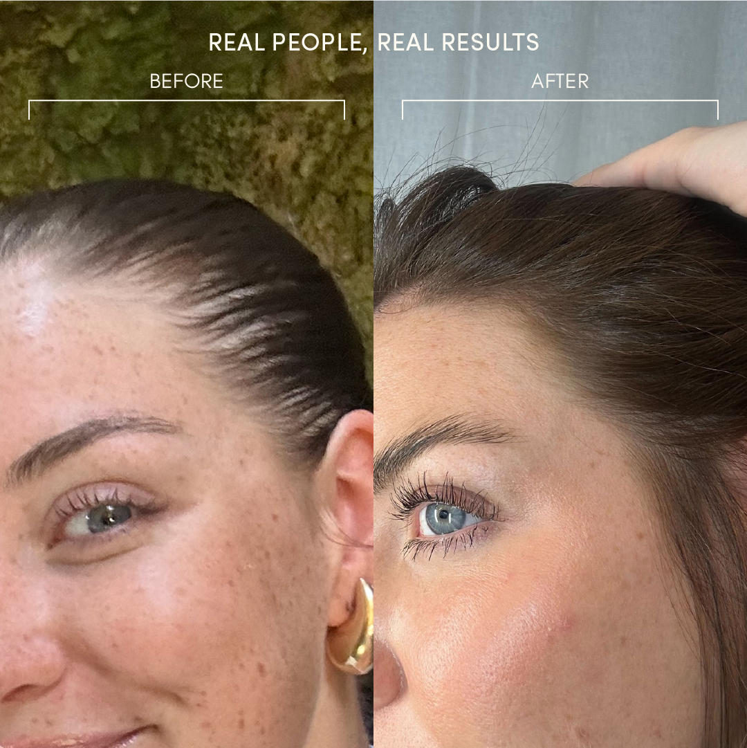 Hair Growth Serum