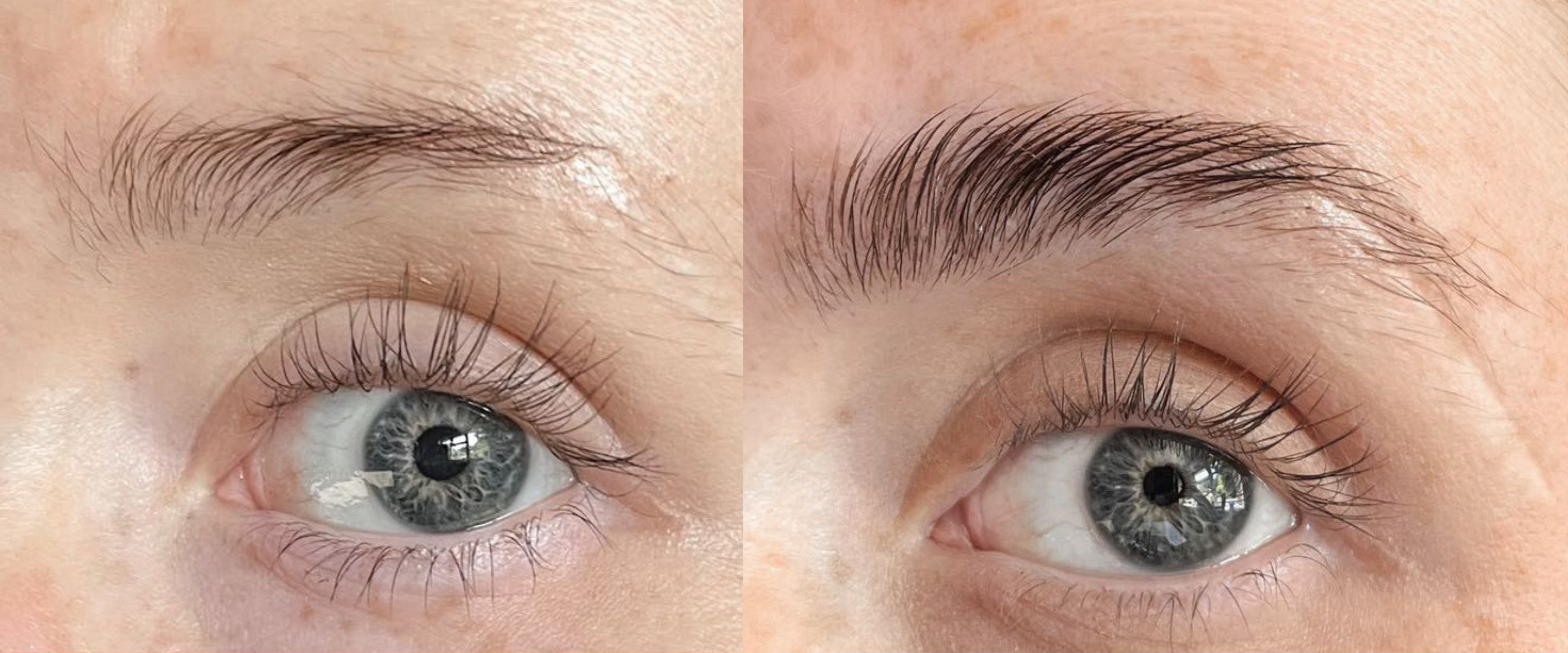 Do Glow For It Serums Address Causes Of Lash & Brow Thinning?