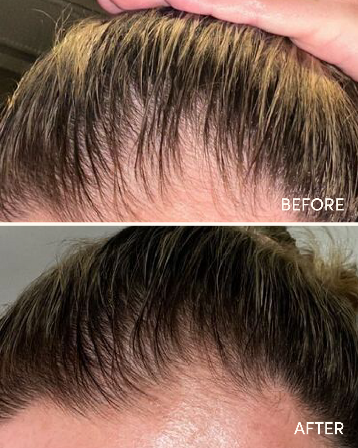 Hair Growth Serum