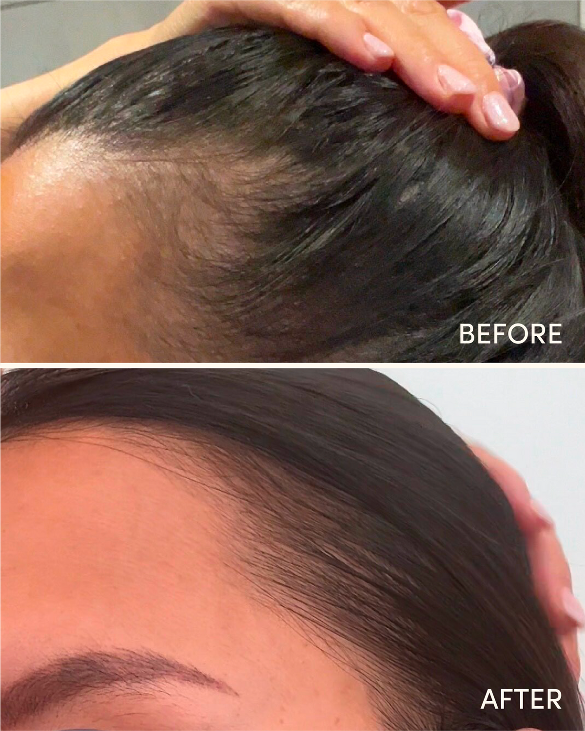 Hair Growth Serum