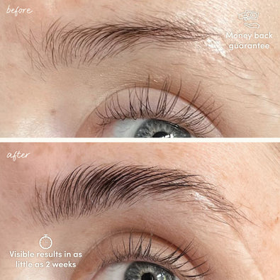 Suero para el crecimiento de las cejas