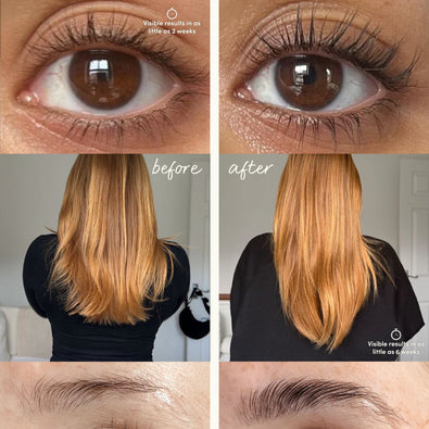 Héroes del crecimiento y el brillo