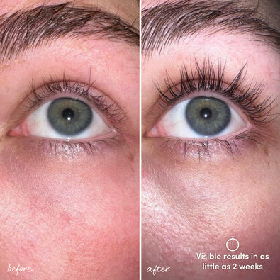 Suero para pestañas