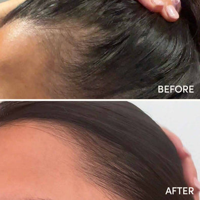 Hair Growth Serum