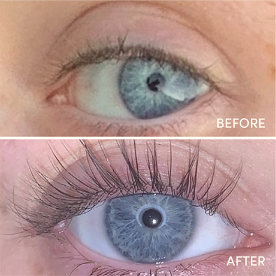 Siero per la crescita delle ciglia