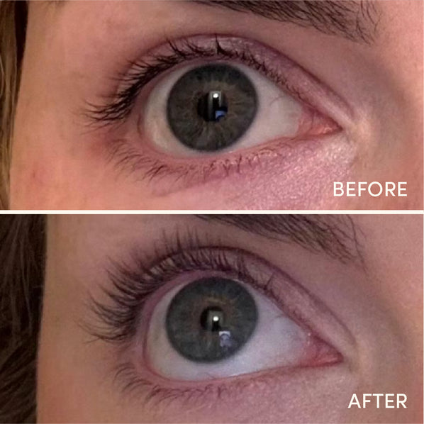 Lash Recharge